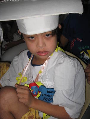 treatments for down syndrome. for kids Downs syndrome,